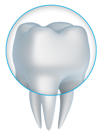 Dental crowns and tooth crown dentistry with a dentist near Phoenix